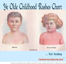 ye olde childhood rashes chart quick reference for todays