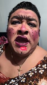 No Se Le Escucha Bien A Alex