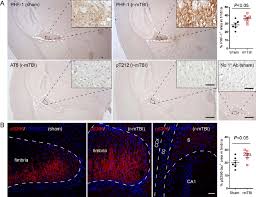 Definitions of fimbria from wordnet. Tau Is Hyperphosphorylated In Fimbria Of The Hippocampus In 3xtg Ad Download Scientific Diagram