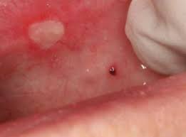 Image result for à¤à¤²à¥ à¤à¥ à¤à¥à¤à¤¸à¤°