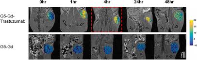 A pet scan will help detect cancer and show how far it has spread. Functionalized Nanoparticles With Targeted Antibody To Enhance Imaging Of Breast Cancer In Vivo Journal Of Nanobiotechnology Full Text