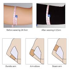 Arm Lift After Weight Loss | Spring Ridge Plastic Surgery