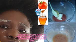 Les différents types de masques : Masque Visage Puissant Pour Enlever Boutons Taches Foncees L Hyperpigmentation Et Alleger La Peau Youtube