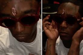 Rapper lil uzi vert shocked his 13 million instagram followers with his latest stunt wednesday after posting a photo of himself with a new forehead piercing featuring what is supposedly a $24 million pink diamond. Look Lil Uzi Vert Shows Off 24 Million Diamond Forehead Implant Inquirer Entertainment