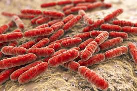 Lactobacillus probiotics improve vaginal health in asymptomatic women