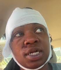 A woman says her boyfriend showed no signs of domestic violence until one  day he accused her of acting and dressing like a stud. *video in comments*