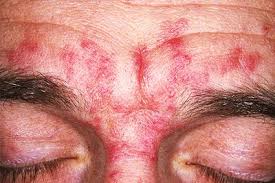 Image result for Dissotis glandulosa