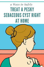9 Ways To Safely Treat A Pesky Sebaceous Cyst Right At Home Home Remedies For Cysts Natural Headache Remedies Migraines Remedies