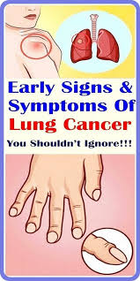 Lung cancer is usually not noticeable during the early stages. Pin On Healthy Foods House