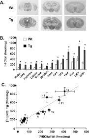 Increased Expression of the 5-HT Transporter Confers a Low- Anxiety  Phenotype Linked to Decreased 5-HT Transmission