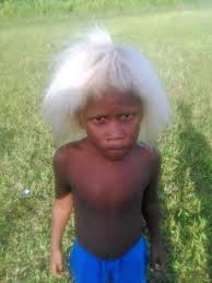 Many assumed the blond hair of melanesia was the result of gene flow — a trait passed on by european explorers, traders and others who visited in the preceding centuries. Clement Lifoia On Twitter Catch This Little Guy In His Backyard And He Just Look Awesome Melanesian Blonde Solomon Islands