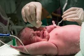 Check spelling or type a new query. Apa Arti Mimpi Melahirkan Inilah 10 Penafsiran Mimpi Melahirkan Sesuai Situasinya Ada Mimpi Baik Dan Buruk Moms Semua Halaman Nakita