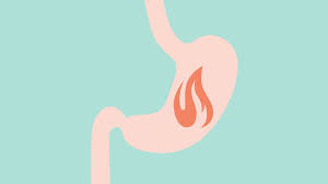 At the entrance to your stomach is a valve, which is a ring of muscle called the these are other common risk factors for acid reflux disease: Heartburn During Pregnancy 12 Ways To Soothe Acid Reflux Health Com