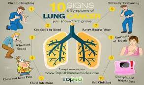 Maintaining the best quality of life possible. How To Tell You Have Lung Cancer Dailytrust
