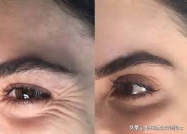 Our course units in skin ageing and aesthetic medicine are specifically designed to support the professional development of qualified medical or dental . After The Age Of 40 The Cost Effective Medical Aesthetic Anti Aging List The Doctor S Summary Is Very Practical Laitimes