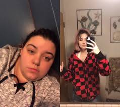 #duet with @destuuuhne I hit myself so hard 😂