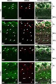 Check spelling or type a new query. Post Natal Expression Of Zbtb20 In Neurons And Astrocytes Of The Download Scientific Diagram