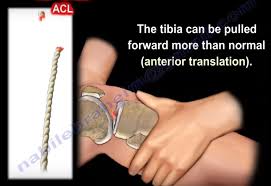 Image result for Lachman Test