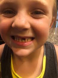 What's the largest amount you got from the tooth fairy ?