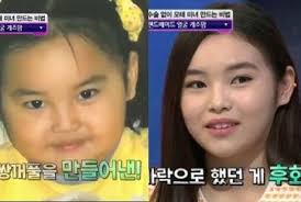 Manfaat yang besar pada timun karena kandungan nutrisi didalamnya mampu berkontribusi dalam perawatan kecantikan wajah. Hanya Dengan Pijatan Dan Sendok Ibu Ini Ubah Wajah Putrinya Jadi Cantik