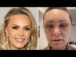 Nancy's Full Circle Transformation