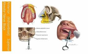 Image May Contain Text Dental Hygiene School Dental Anatomy Dental Hygenist