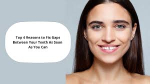 Wondering if invisalign is right for you? Top 4 Reasons To Fix Gaps Between Your Teeth As Soon As You Can