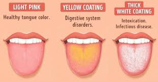 What Your Tongue Is Trying To Tell About Your Health Holistic Remedies In 2020 Healthy Tongue Tongue Health Health Chart