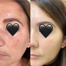 Virtual Transformations