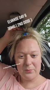 elvanse day 6. 2nd dose of 30mg. #psychiatryuk #adhdtiktok #adhd #adhd...