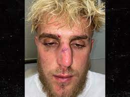 What about when jake paul made videos that accused/lied faze banks of physically assaulting his assistant in the club? Jake Paul Shows Bloody Footage Of Broken Nose He Suffered 3 Weeks Before Fight