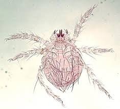 Image result for Trombicula autumnalis