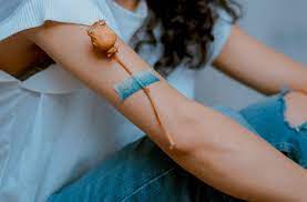Side affects of removal? 39 years experience obstetrics and gynecology. Nexplanon Removal Allbodies