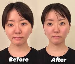 骨美整 salon