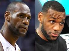 Image result for alopecia images for black  men