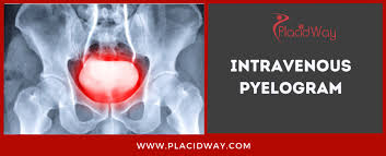 Image result for Intravenous Pyelogram