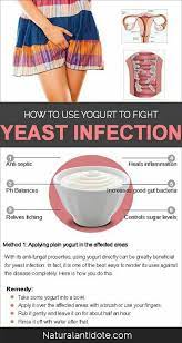 Pin By Angel Enshirabapa On Womens Health Yeast Infection Treatment Treat Yeast Infection Yeast Infection Causes