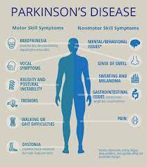 Despite current medical breakthroughs, parkinson's remains a disease best managed through ongoing treatment & medication. Parkinsons Disease Dr Prem Pillay