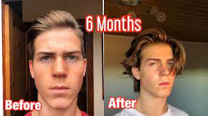 Not all of your hair grows at the same rate, so patches on your cheeks may fill in later. Mens Hair Growth Time Lapse 6 Months From Shaved Undercut Youtube