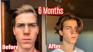 Of course, what that growth looks like is dependent on your hair type. Mens Hair Growth Time Lapse 6 Months From Shaved Undercut Youtube