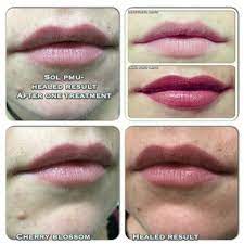 Image Result For Pmu Lips Healed Lip Healing Lips Beauty
