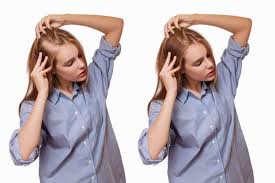 زراعة الشعر للنساء 3 طرق مختلفة تجربتي مع أفضل قصة نجاح جميلتي
