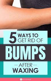 Bumps After Waxing Causes 5 Home Remedies And Prevention Tips After Waxing Brazilian Wax Tips Waxing