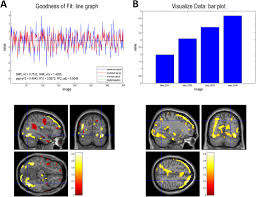 #spm2017 #spm *dengaq ni mael nk habaqpic.twitter.com/mwyotbfi0c. Macs A New Spm Toolbox For Model Assessment Comparison And Selection Biorxiv