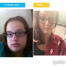 No Swollen Face This Year!!! by Carmen Bone