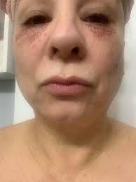 Skin Deep Anti-Aging Spa