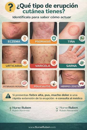 🩺 ¿QUÉ TIPO DE ERUPCIÓN CUTÁNEA TIENES? 📚 Publicación educativa que  orienta sobre los tipos más comunes de erupciones cutáneas y su  reconocimiento básico. ⚠️ Contenido con fines educativos en salud. No