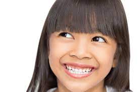 子供にガミースマイルは遺伝するの？原因と治療法も解説 - 南青山矯正歯科・審美歯科