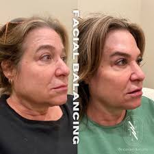 👄 Custom Facial Balancing 👩🏼‍⚕️ Nurse Kristy 💵 $2400+ ⏰ 1 hr 15 mins  📍4239 Main St, Manayunk 📲 Booking link in bio! Hours: M-W: 9:00-5:30pm  Th/F: 10:00-5:30pm EXTENDED HOURS: Book