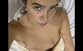 Box Jellyfish In Thailand: Known Attacks, Risk Areas & Prevention